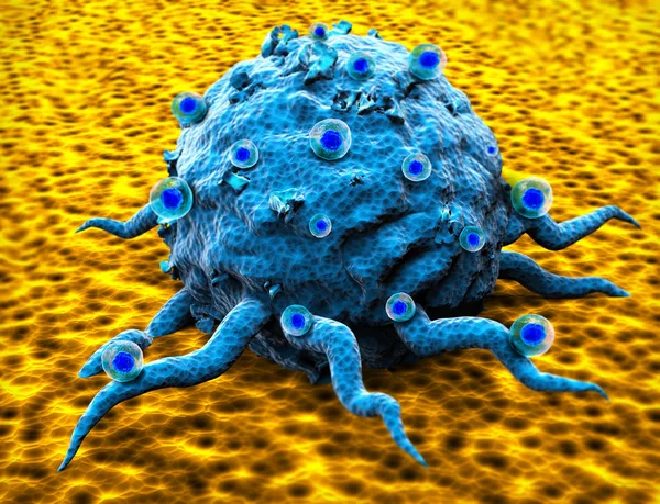 Cancer Cell Growth Culture Electron Microscope — Stock Photo, Image