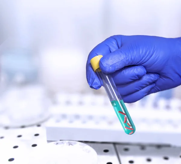 Teste Bactérias Tubo Teste Laboratório Mão Analista Uma Luva Plástico — Fotografia de Stock