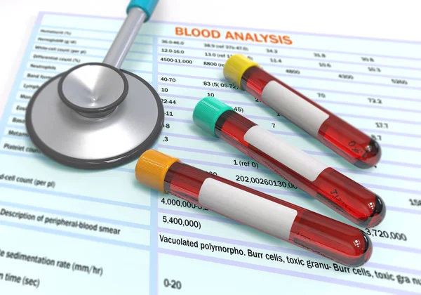 Výsledky Testovací Analýzy Krevní Zkumavky Jsou Tabulce Koncepce Diagnózy Pacienta — Stock fotografie