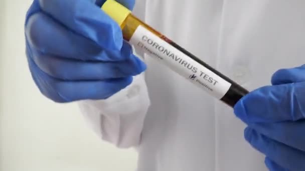 Hastane Laboratuvarında Coronavirus Kan Testi — Stok video