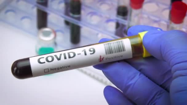 Hastane Laboratuvarında Coronavirus Kan Testi — Stok video