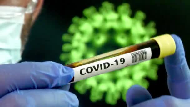 Exame Sangue Coronavírus Laboratório Hospitalar Positivo Para Covid — Vídeo de Stock