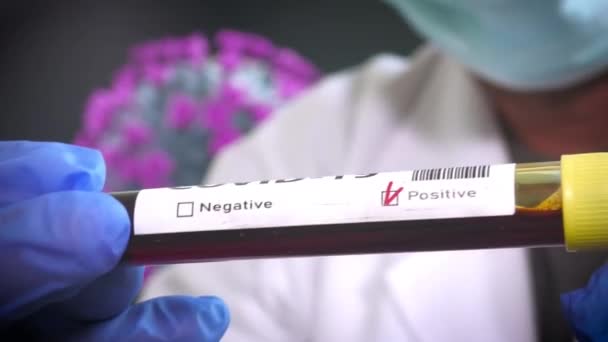 Hastane Laboratuvarında Coronavirus Kan Testi — Stok video