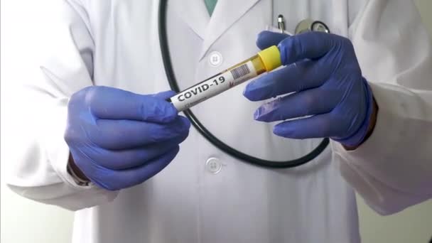 Tes Darah Coronavirus Laboratorium Rumah Sakit — Stok Video