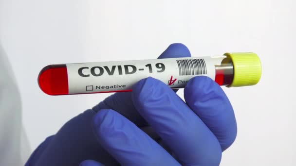 Análisis Sangre Del Coronavirus Laboratorio Hospitalario Positivo Para Covid — Vídeo de stock