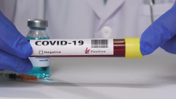 Análisis Sangre Del Coronavirus Laboratorio Hospitalario Fue Positivo Para Covid — Vídeo de stock