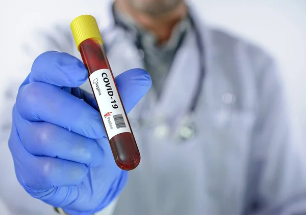 Análisis Sangre Del Coronavirus Laboratorio Hospitalario Fue Positivo Para Covid — Foto de Stock
