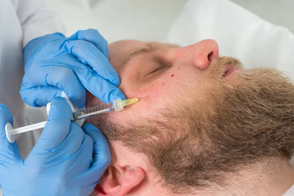 Gutaussehender Mann Bekommt Spritze Konzept Der Ästhetischen Schönheit — Stockfoto