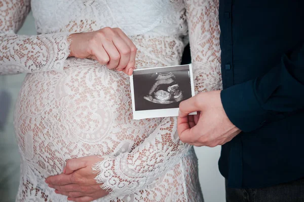 Hombre y mujer sostienen una instantánea de una ecografía en un vientre embarazada —  Fotos de Stock