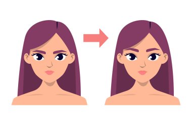 Vektör izole edilmeden önce ve sonra kanat kaldırma ameliyatı