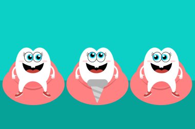 Dübel mutlu dişler ağız arasında ile diş kavramı vektör resmi. Dental implant kavramı. EPS vektör çizim.