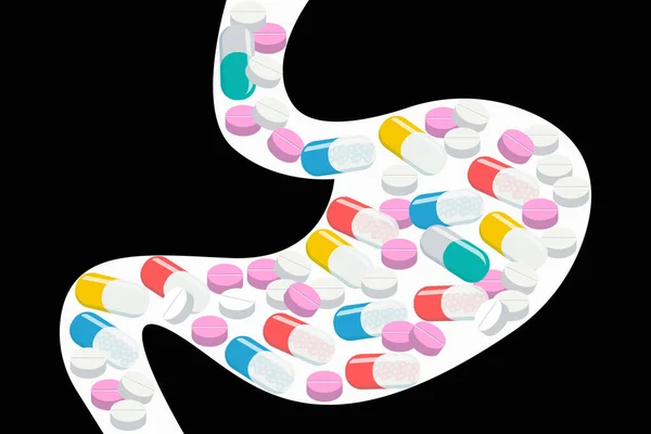 Διαφορετικά Χάπια Και Πώματα Πλήρωσης Λευκό Στομάχι Υπερδοσολογίας Δηλητηρίαση Χάπια — Διανυσματικό Αρχείο