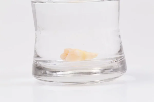 コップの水の中の虫歯 — ストック写真