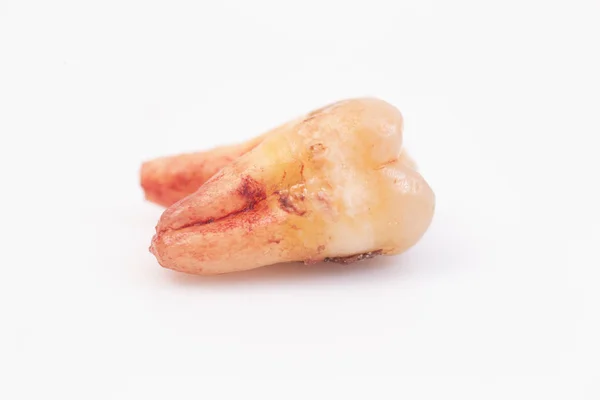 Beyaz arka plan üzerinde dişler üzerinde Çürükler