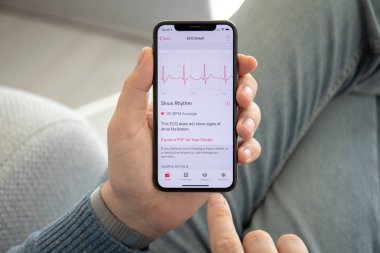 Anapa, Rusya - 17 Şubat 2019: Adam el Apple Watch serisi 4 ve EKG app üstünde belgili tanımlık perde ile iphone X