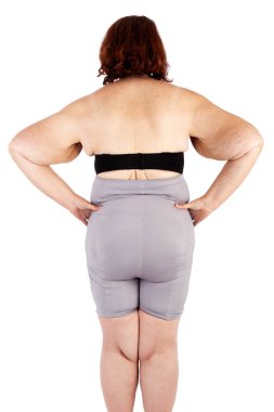 Orta bebekler ve aşırı kilo kaybı sonra cildin sarkmasını kadınla yaşlı. Poster ve meme, daha önce brachioplasty, panniculectomy, karın germe ve mumya makyaj Avustralya için ilham kaynağı.