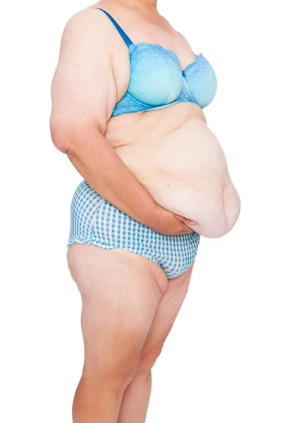 Middle Aged Woman Sagging Skin Babies Extreme Weight Loss Inspiration — Stock Photo, Image