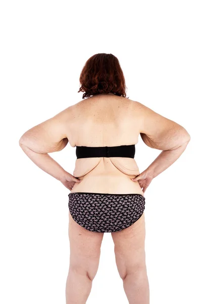 中年赤ちゃんや極端な体重減少後の皮膚のたるみを持つ女性 ポスターとミームの前にオーストラリアで Brachioplasty 脂肪層切除 腹部およびミイラの変身のためのインスピレーション — ストック写真