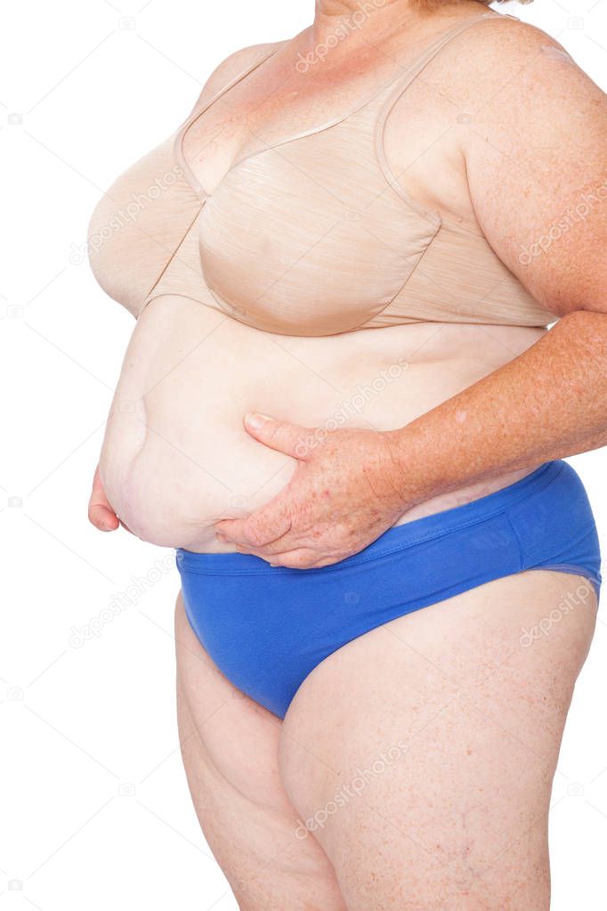 Menopausal woman with weight gain after brachioplasty, panniculectomy, abdominoplasty and mummy makeover. 45 degree view left, hands holding excess abdominal weight, copy space. Makeover inspiration.
