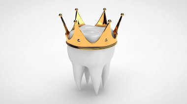 Altın bir taç ile taçlanmış beyaz bir insan diş 3d render. Bir diş kliniğinde tedavi, restorasyon, protez fikri. Beyaz arka plan üzerinde 3d görüntü, izole.