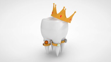 Altın bir taç ve değerli taşlar ile yüzük ile beyaz bir insan diş 3d render. Lüks bir yaşam fikri, pahalı ve yüksek kaliteli tedavi, protezler. Yalıtılmış görüntü