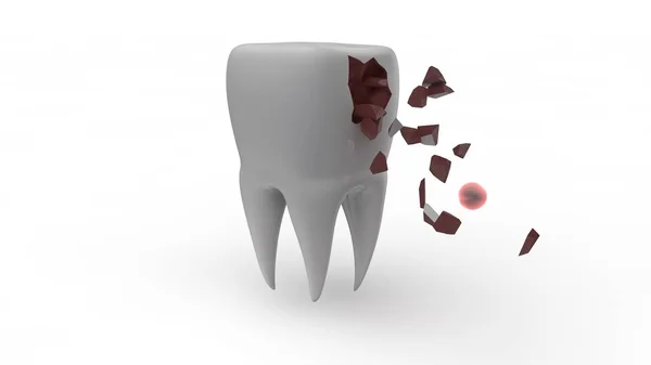 Representación en 3D de un diente humano enfermo, destruido. Ilustración para promover un estilo de vida saludable y el cuidado de la cavidad oral. Ilustración 3D aislada sobre fondo blanco — Foto de Stock