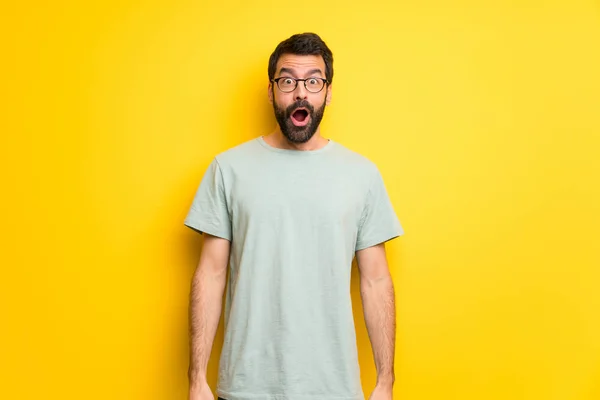 Homem Com Barba Camisa Verde Com Expressão Facial Surpresa Chocada — Fotografia de Stock