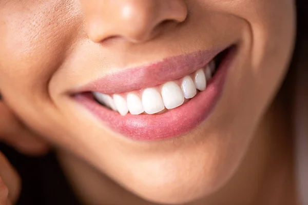 Закройте красивую улыбку сияющими белыми зубами — стоковое фото
