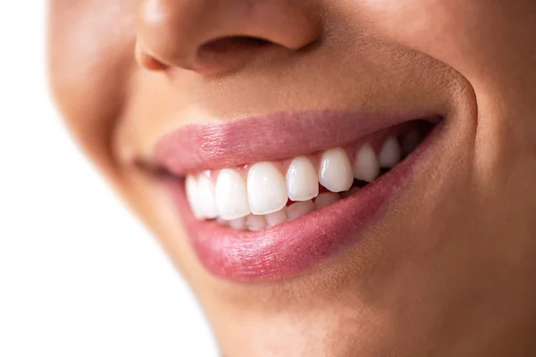 Zbliżenie pięknego uśmiechu z błyszczącymi białymi zębami — Zdjęcie stockowe
