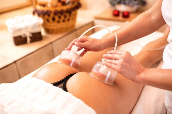 Ventosas de vácuo aplicadas em terapia anti-celulite — Fotografia de Stock