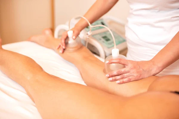 Masseuse applying vacuum cups for cellulite reduction — Stock Photo, Image