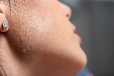 gri Üzerinde ısı muzdarip yüzünde ter ile genç kadının kırpılmış görünümü 