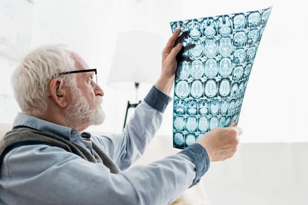 Спокойный Пожилой Человек Очках Смотрит Рентгеновские Снимки — стоковое фото
