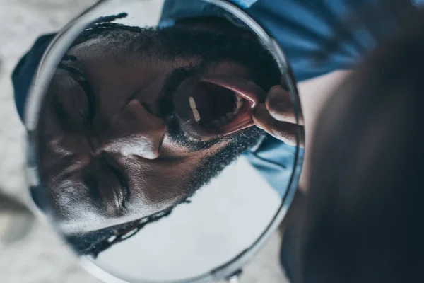 Афроамериканський Чоловік Дивиться Дзеркало Страждаючи Від Зубного Болю — стокове фото