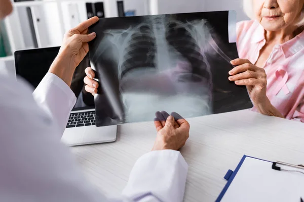 Обрізаний Вид Пацієнта Рожевою Стрічкою Лікарем Тримає Рентгенівський Знімок Біля — стокове фото