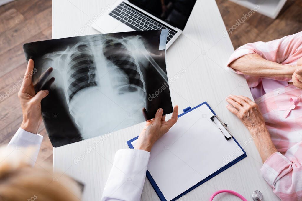 Overhead view of patient near doctor holding chest x-ray at workplace