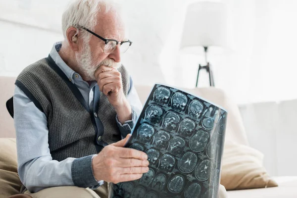 Konzentrierter Senior mit Brille betrachtet Röntgenbild — Stockfoto