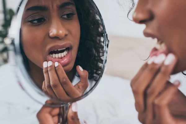 Giovane donna afroamericana che si guarda allo specchio mentre soffre di dolore ai denti — Foto stock