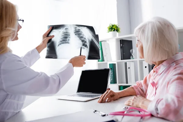 Vista lateral del paciente y el médico mirando la radiografía de tórax cerca de la computadora portátil en la mesa - foto de stock