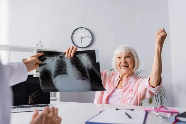 Foco seletivo da mulher idosa com sim gesto segurando raio-x perto do médico — Fotografia de Stock