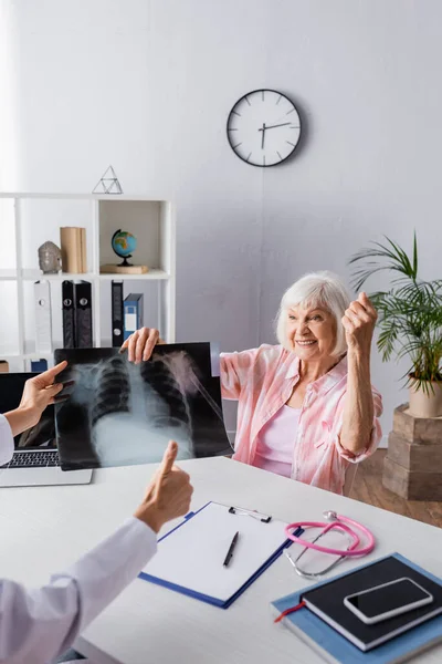 Mujer mayor con sí gesto sosteniendo rayos X cerca del médico con el pulgar hacia arriba - foto de stock