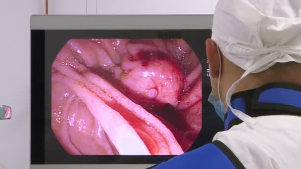 医師は、腹部の手術を行うために医療機器やビデオカメラを使用します . — ストック動画