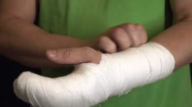 Bir adam alçıda kolunu kaşır. .