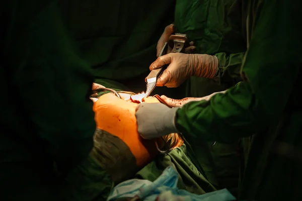 Csípőprotézis műtét. modern artroskopikus eszközökkel. Kórházi háttér — Stock Fotó