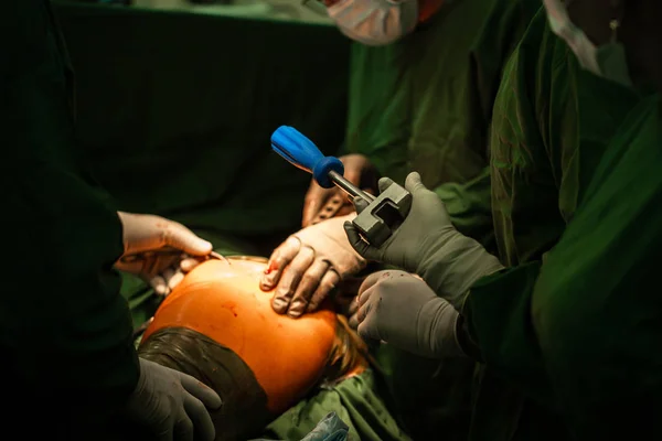 Az orvosok csípőprotézist operálnak. Ortopéd sebészek a csapatmunkában — Stock Fotó