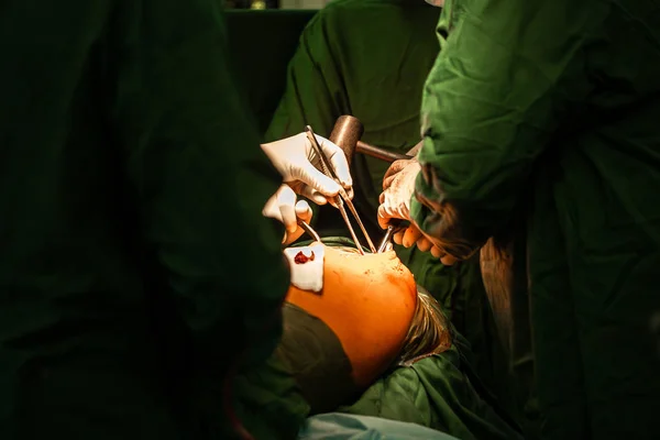 Ortopéd sebész, aki nyílt redukciót végez, hogy rögzítse a törött csontot a műtőben a sebészeti lámpa fényénél. Az orvos csípőprotézis csapat. Orvosi fogalom — Stock Fotó