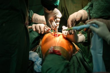 Ameliyat sırasında kullanılan cerrahi ekipman. Metin için boşluk