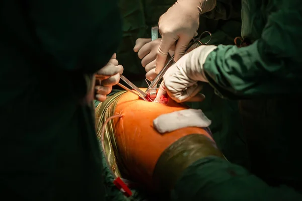 Ομάδα χειρουργών που εκτελούν εγχείρηση σε ασθενή σε νοσοκομείο — Φωτογραφία Αρχείου