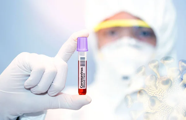 Coronavirus 2019 Ncov Blood Sample Нова Епідемічна Корона Вірус Вибух — стокове фото