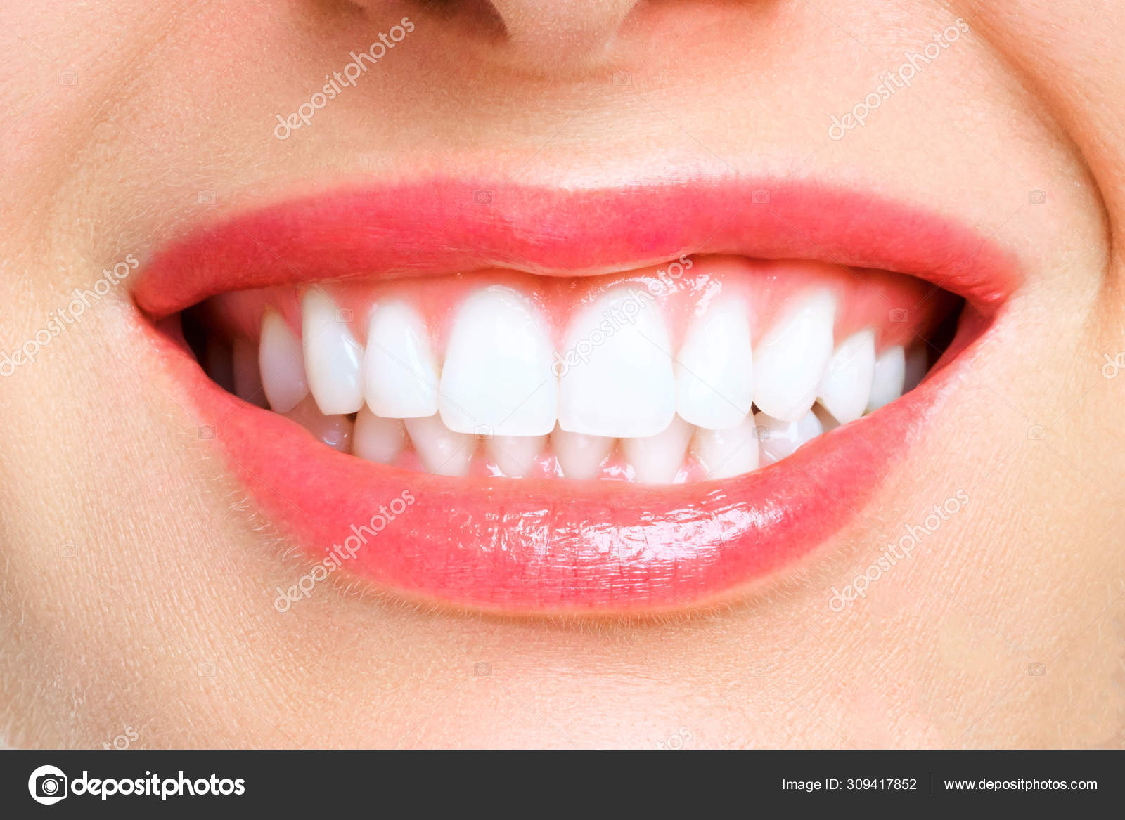 Perfect Healthy Teeth Smile Of A Young Woman Teeth Whitening Dental Clinic Patient Stomatology Concept Royalty Free Photo Stock Image By C Arribalko Perfect Healthy Teeth Smile Of A Young Woman Teeth Whitening Dental Clinic Patient Stomatology Concept Royalty Free Photo Stock Image By C Arribalko